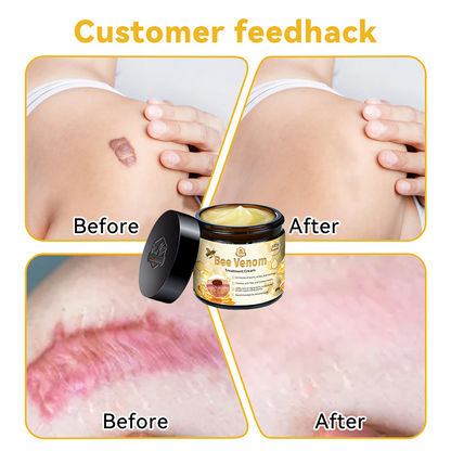 ✨𝑇𝑢𝑟𝑜𝑛𝑢™ Bee Venom Skin Treatment Cream（EMA 𝑅𝑒𝑐𝑜𝑚𝑚𝑒𝑛𝑑𝑒𝑑）